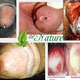 Illustration for article titled Jual Obat Kencing Nanah Di Surabaya
